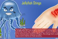 jellyfish-stings What Are The Tax Implications Of Loan Forgiveness